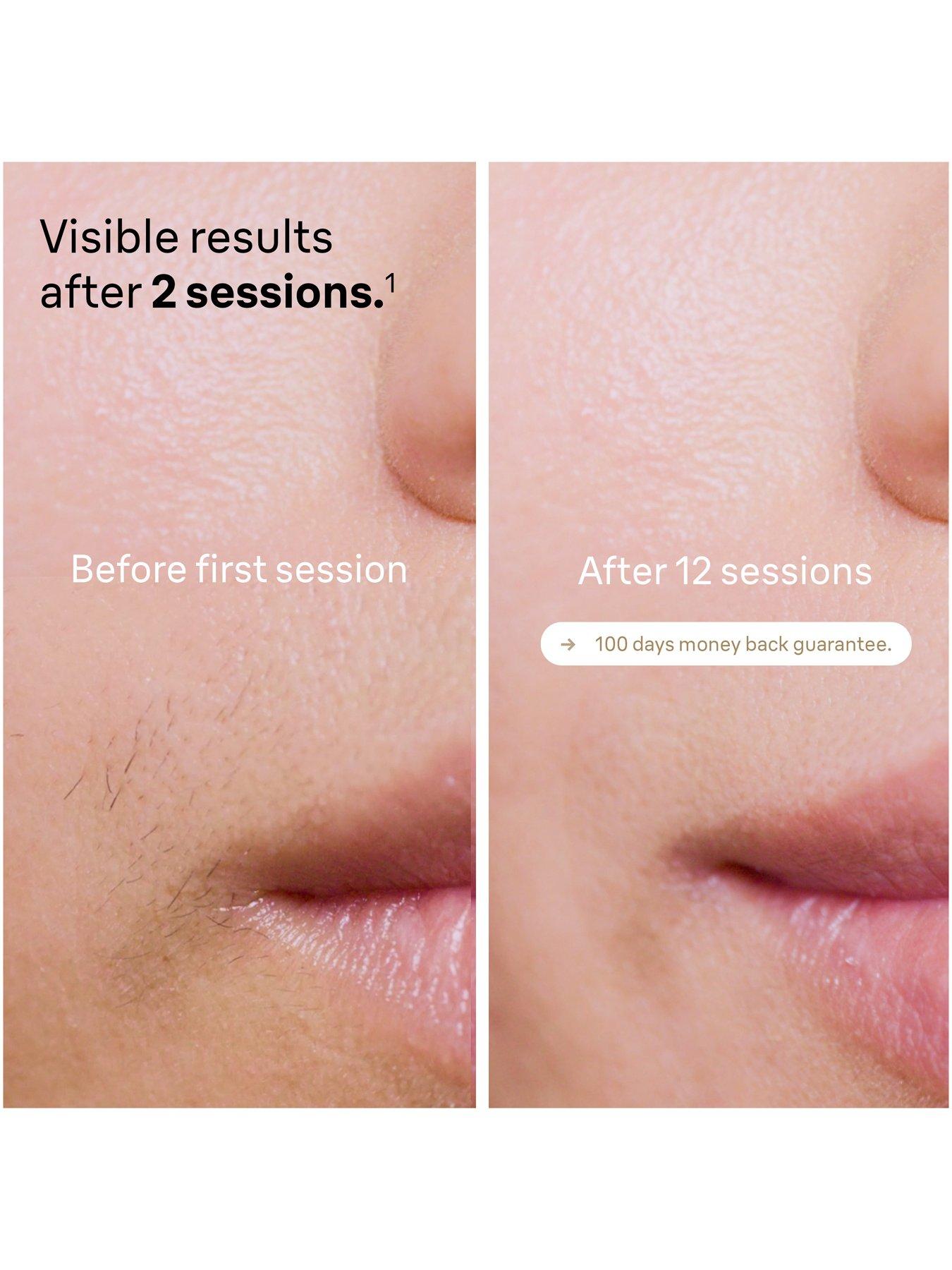 Image 3 of 7 of Braun IPL Silk-Expert Pro 5, At Home Hair Removal Device with Pouch PL5124&nbsp;- White/Gold