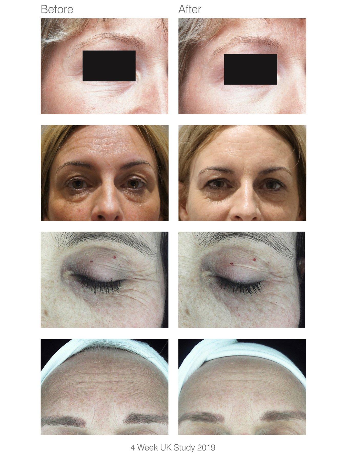 Image 5 of 6 of Rio faceLITE Beauty Boosting LED Face Mask