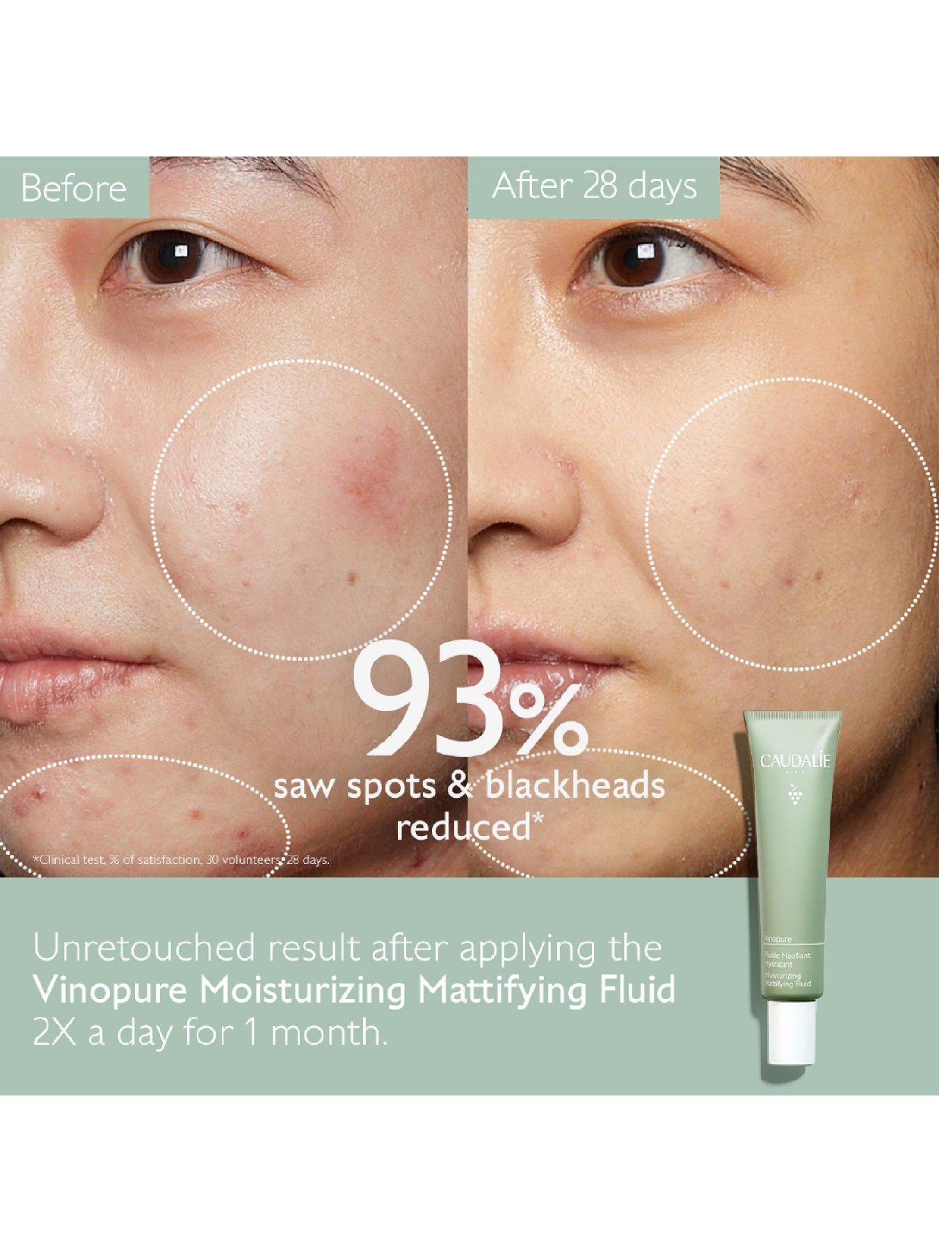 caudalie-vinopure-moisturizing-mattifying-fluidstillFront