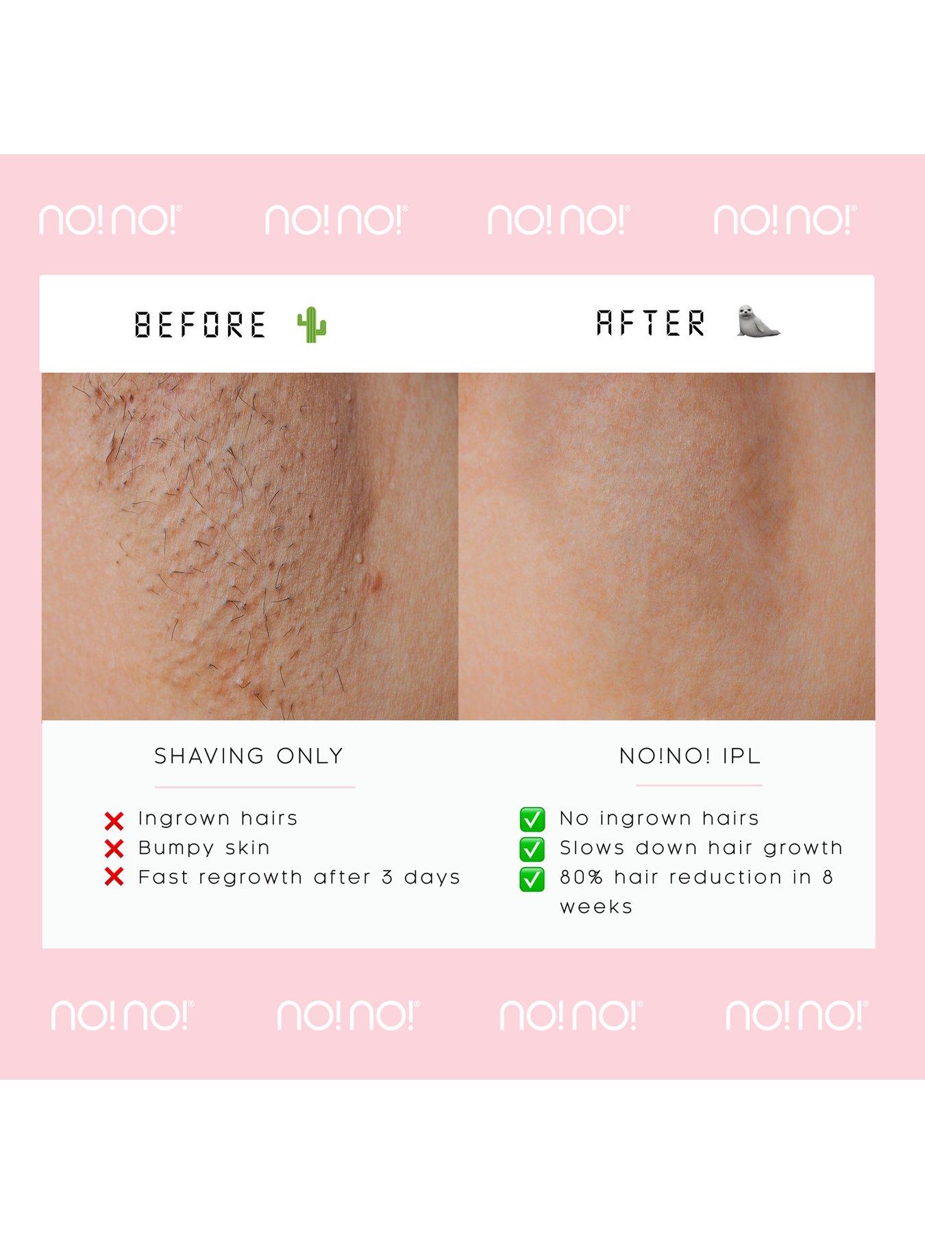 nono-iplnbspicedetail