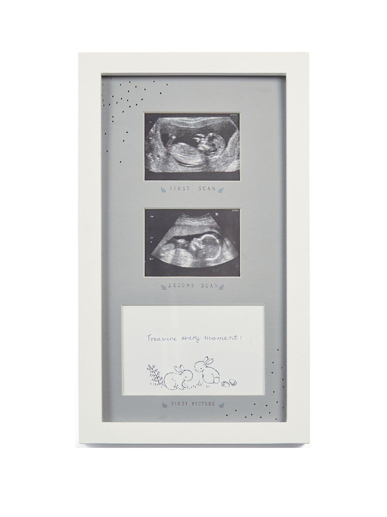 Mamas & Papas Baby Double Scan Photo Frame - Forever Treasured