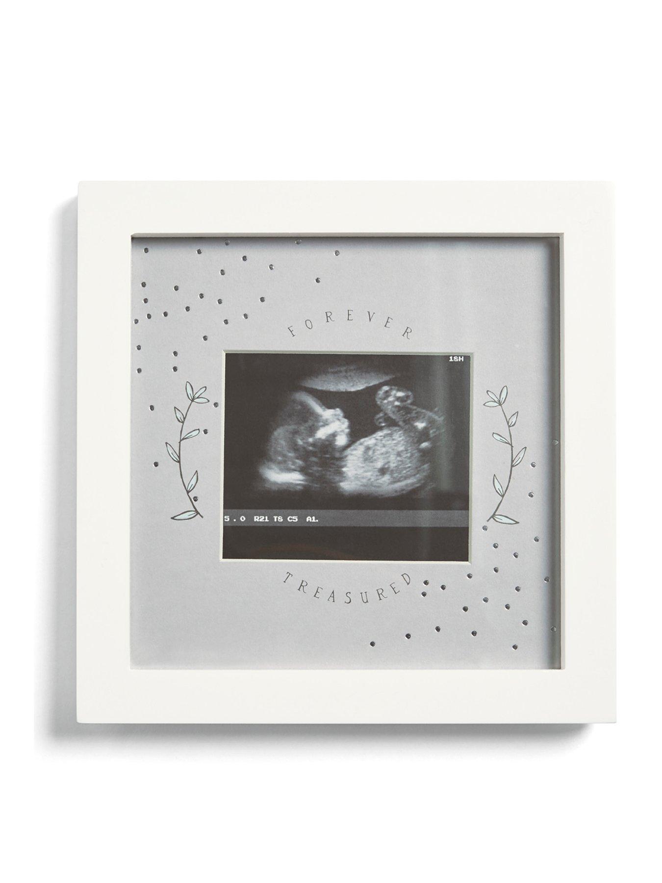 mamas-papas-baby-scan-photo-frame-white-forever-treasured