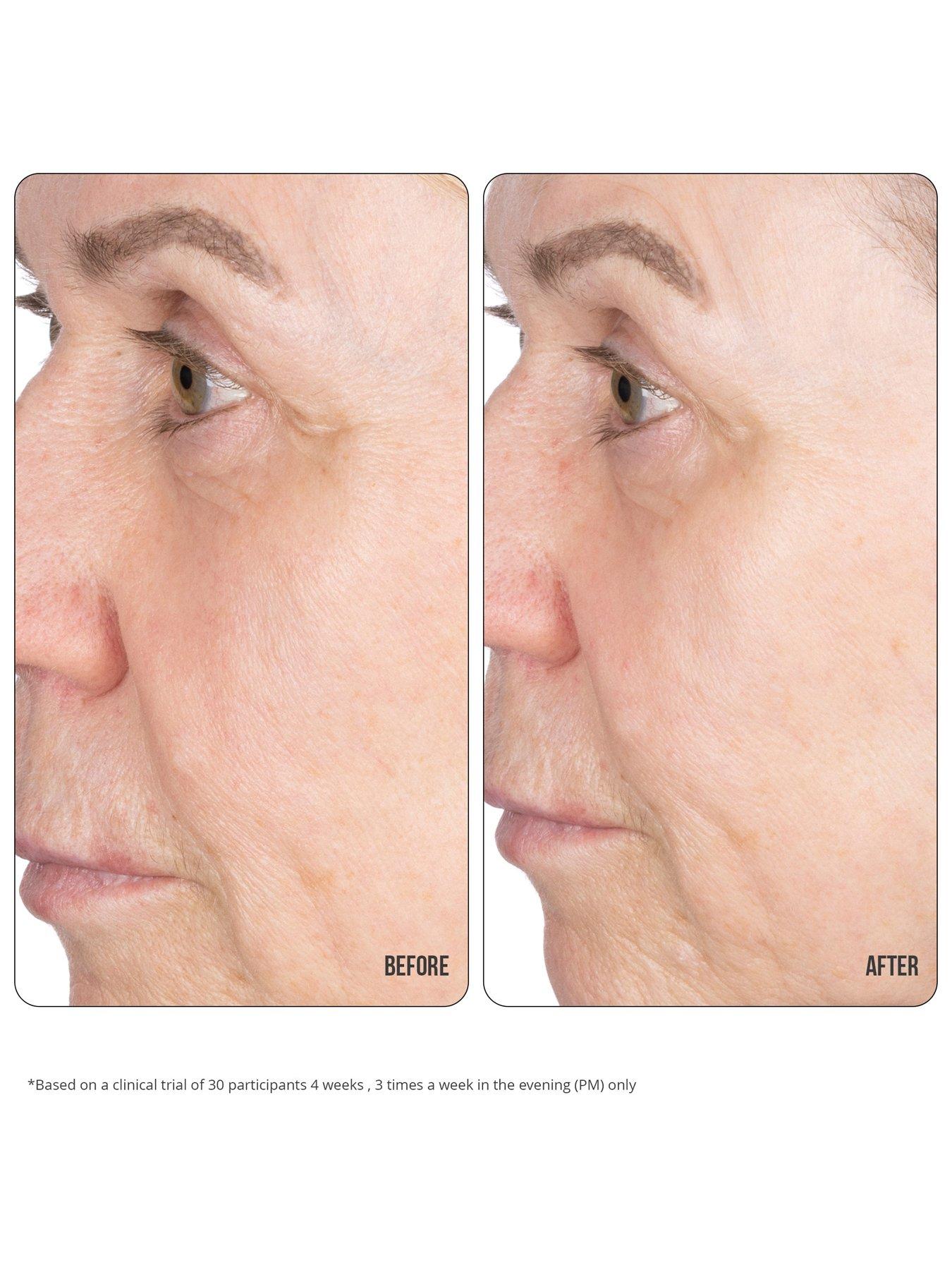 Image 3 of 4 of Nip + Fab Retinol Fix Concentrate Extreme 10%