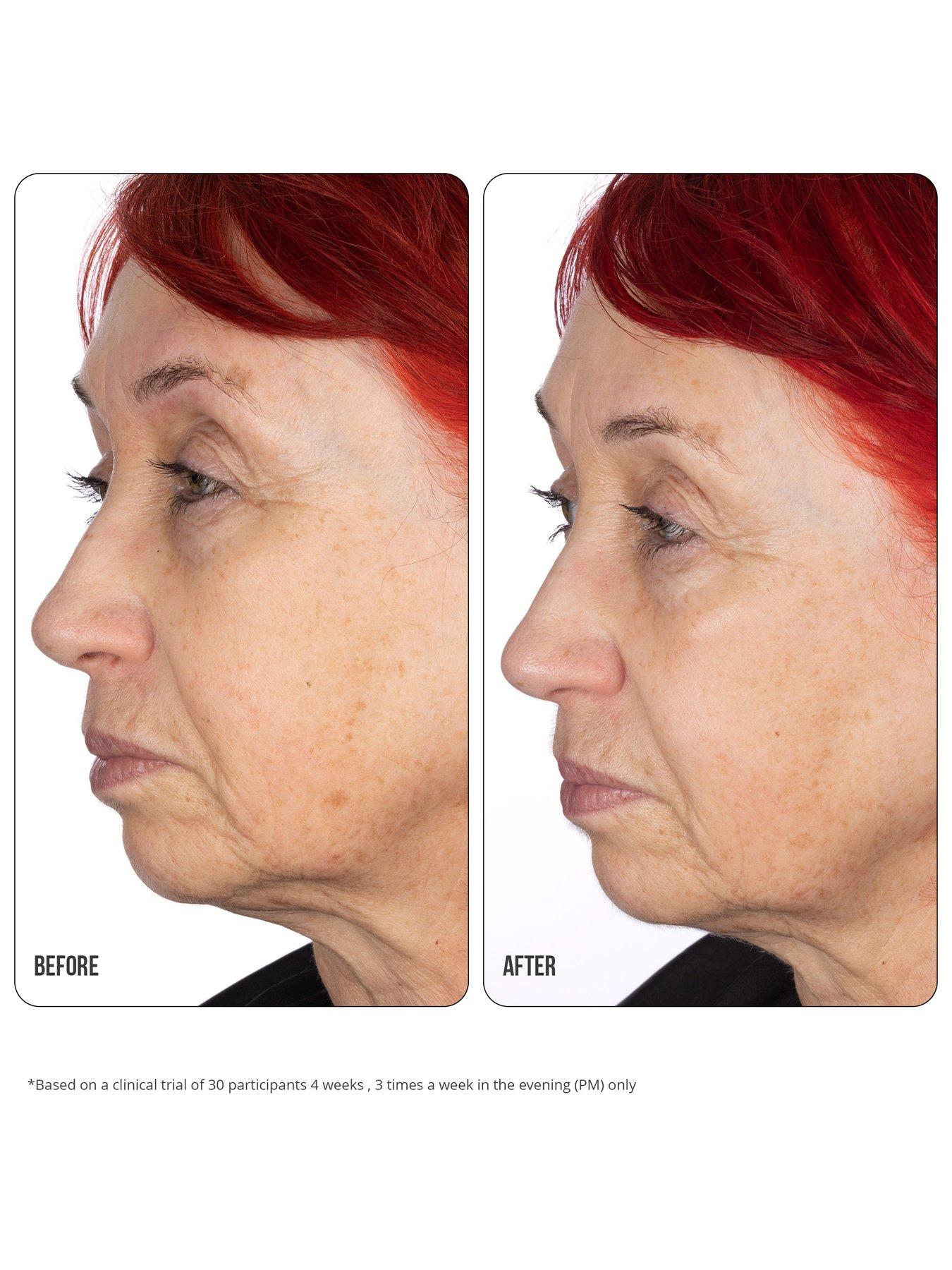 Image 4 of 4 of Nip + Fab Retinol Fix Concentrate Extreme 10%