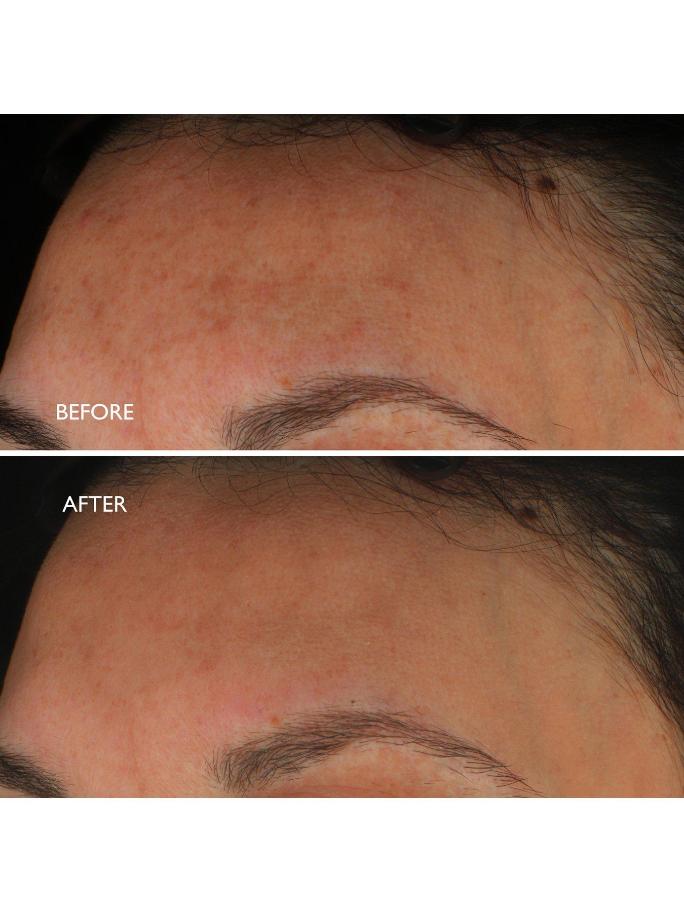 gatineau-gatineau-age-benefit-hyperpigmentation-repair-30mldetail