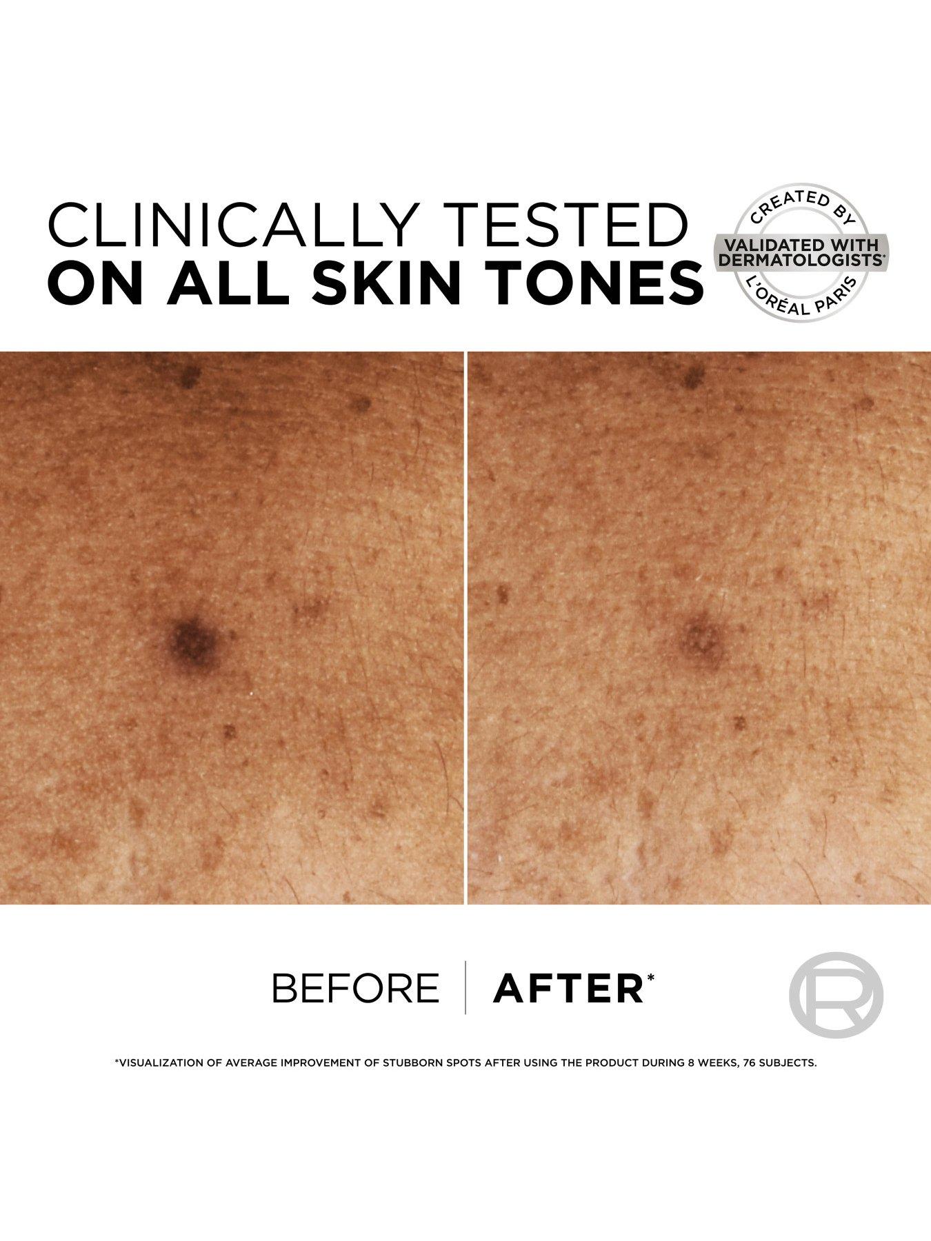 loreal-paris-loreal-paris-bright-reveal-niacinamide-dark-spot-routineback