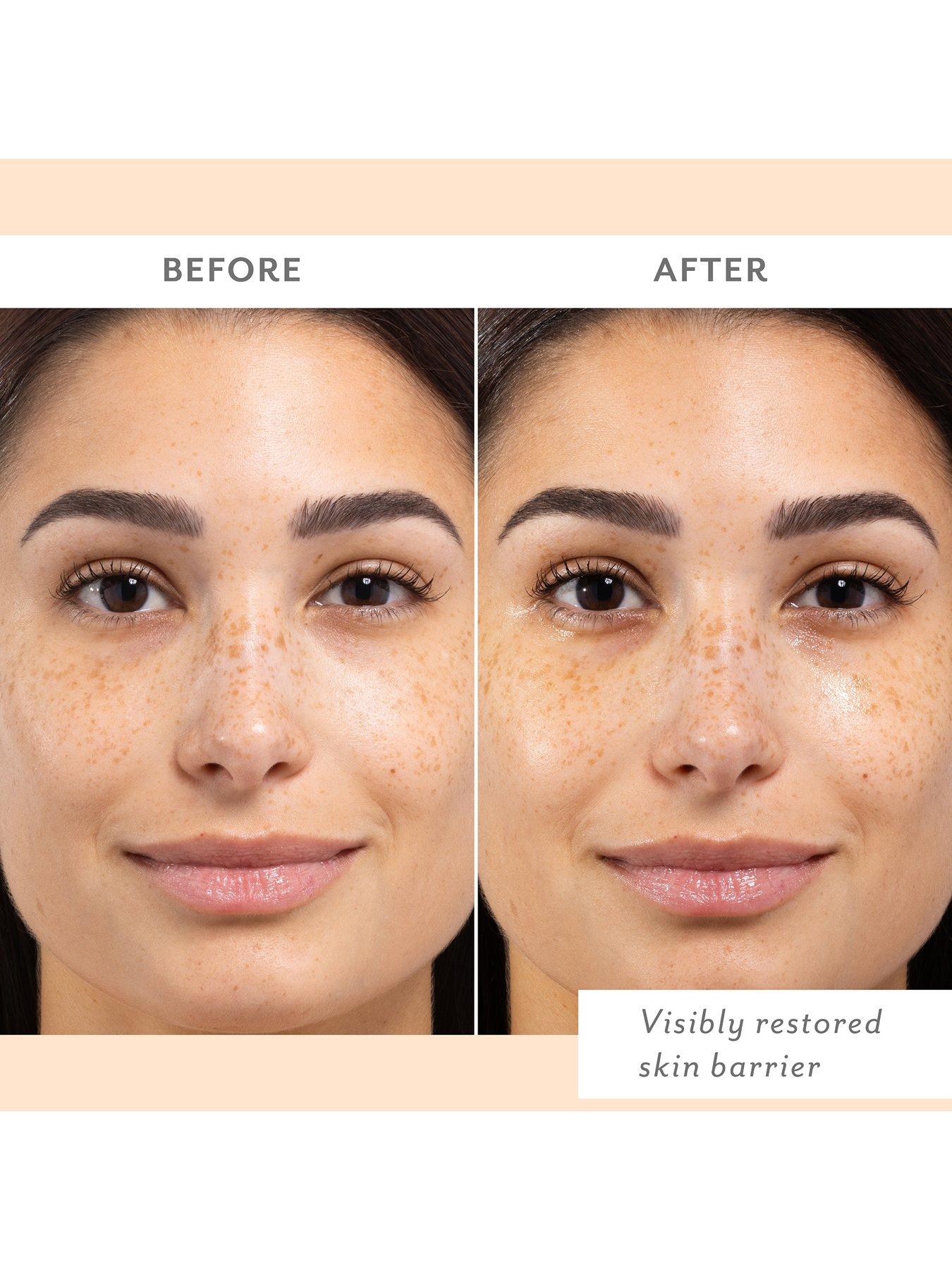 Image 4 of 7 of Patchology Skin Remedy Barrier-Boosting Sheet Mask
