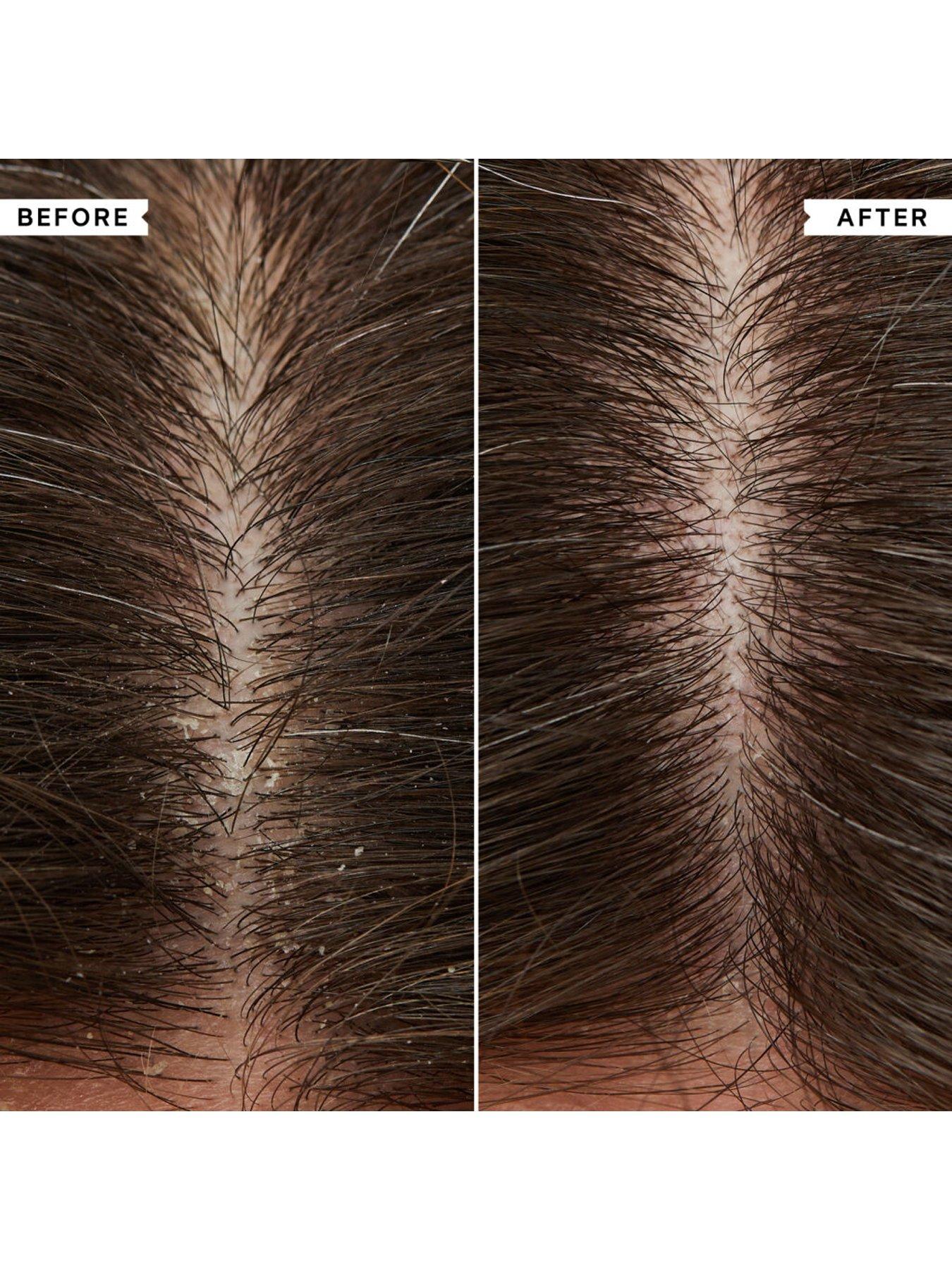 philip-kingsley-flaky-itchy-scalp-shampoo-75mloutfit