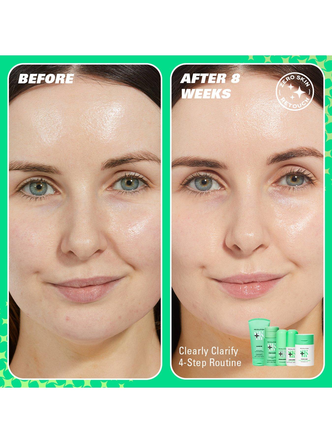 Image 5 of 7 of Revolution Beauty London Revolution Skin Clearly Clarify Starter Kit