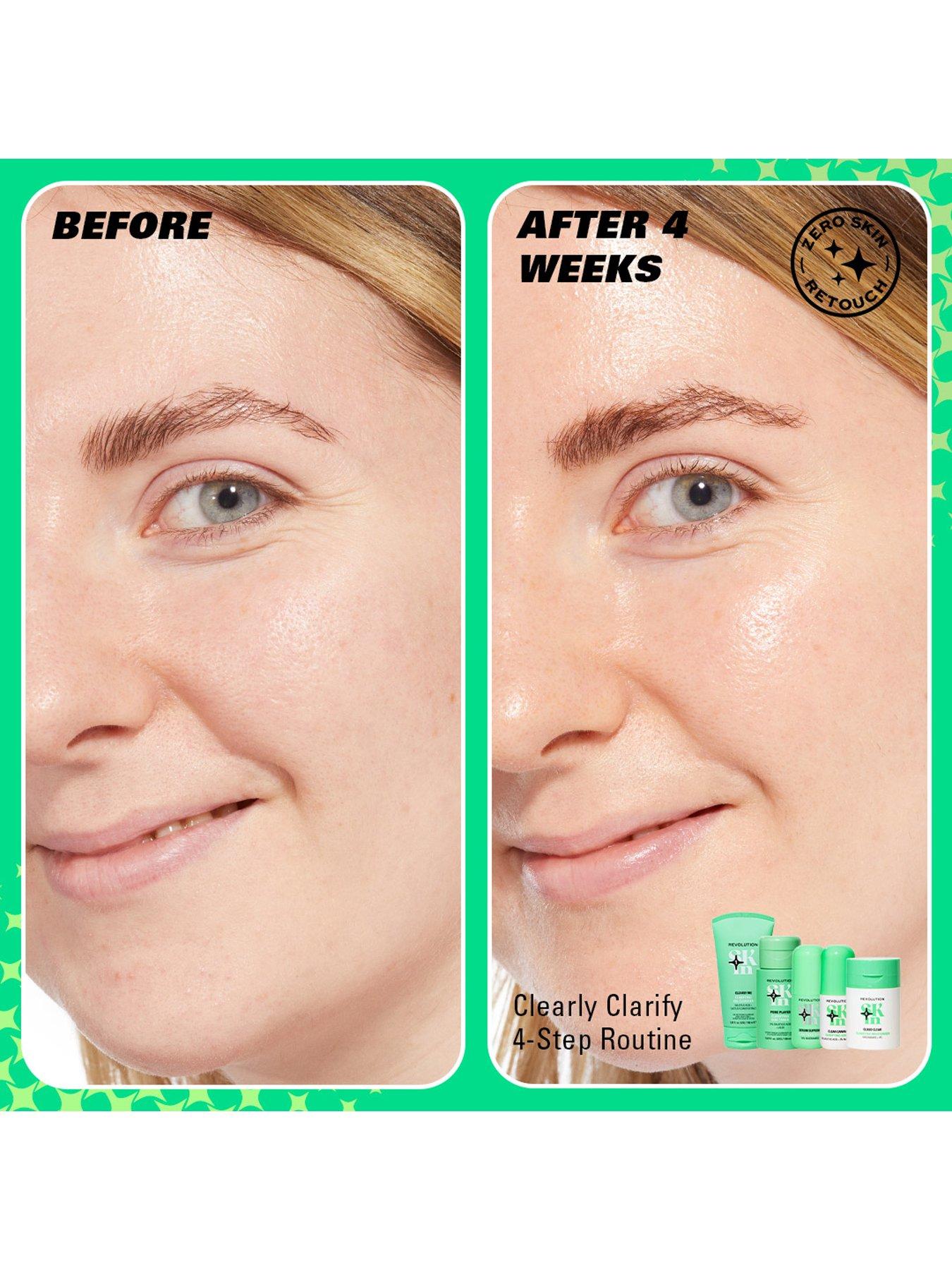 Image 6 of 7 of Revolution Beauty London Revolution Skin Clearly Clarify Starter Kit