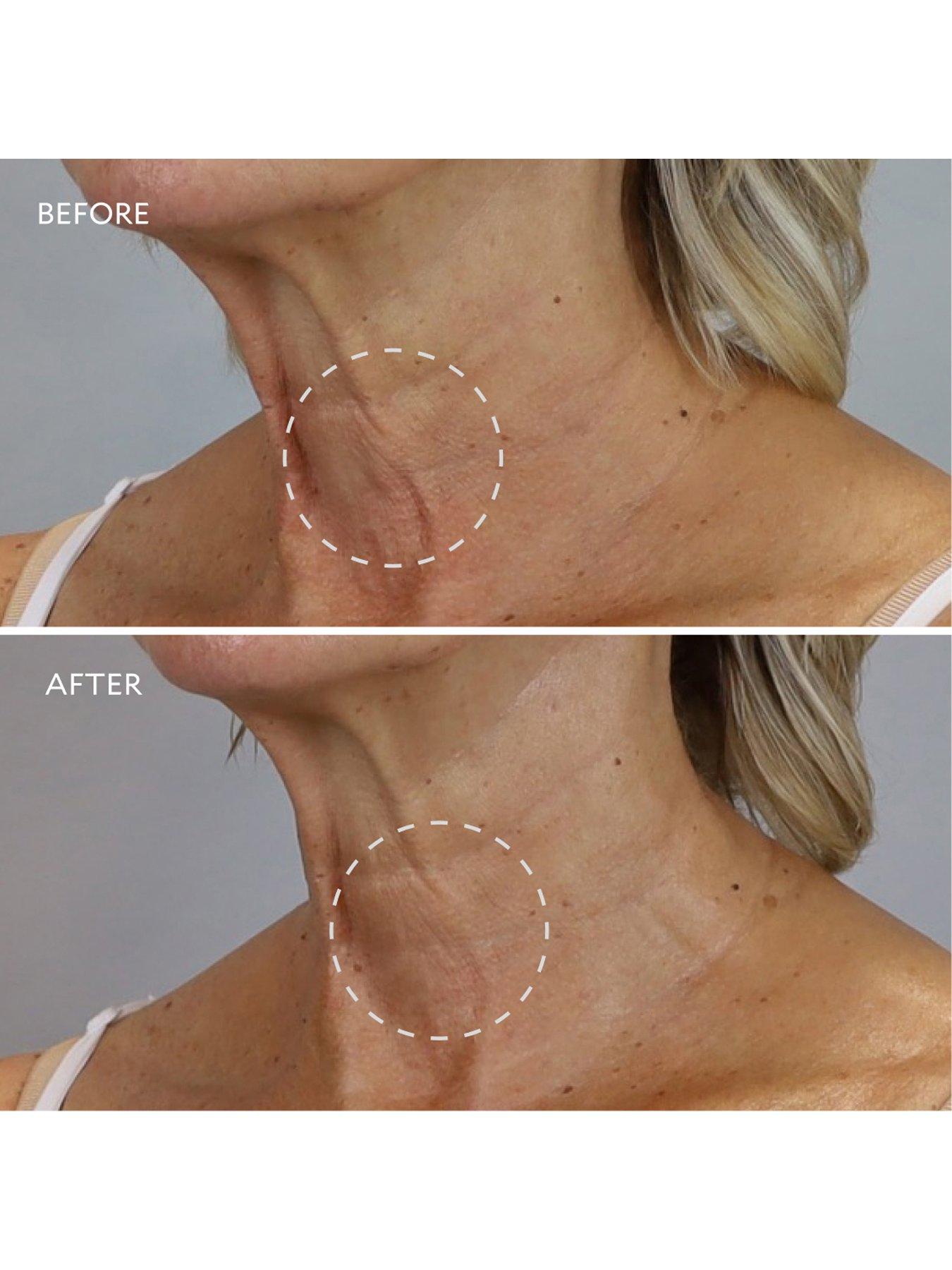 Image 7 of 7 of Gatineau Age Benefit Intensive Neck Decollete Cream 50ml