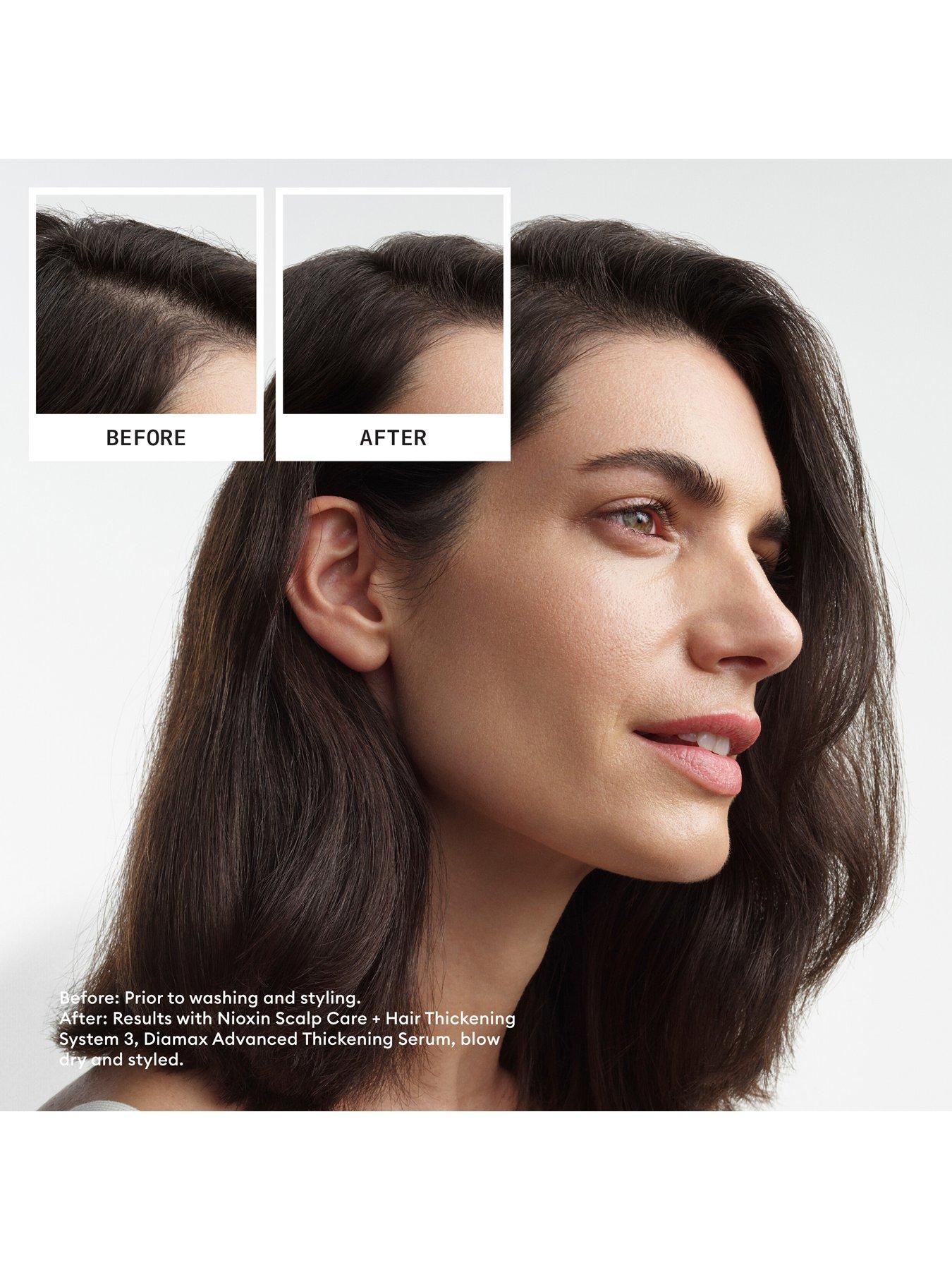 Image 5 of 7 of Nioxin Scalp + Hair Thickening System 3 for Coloured, Dry and Damaged Hair with Light Thinning, Loyalty Kit