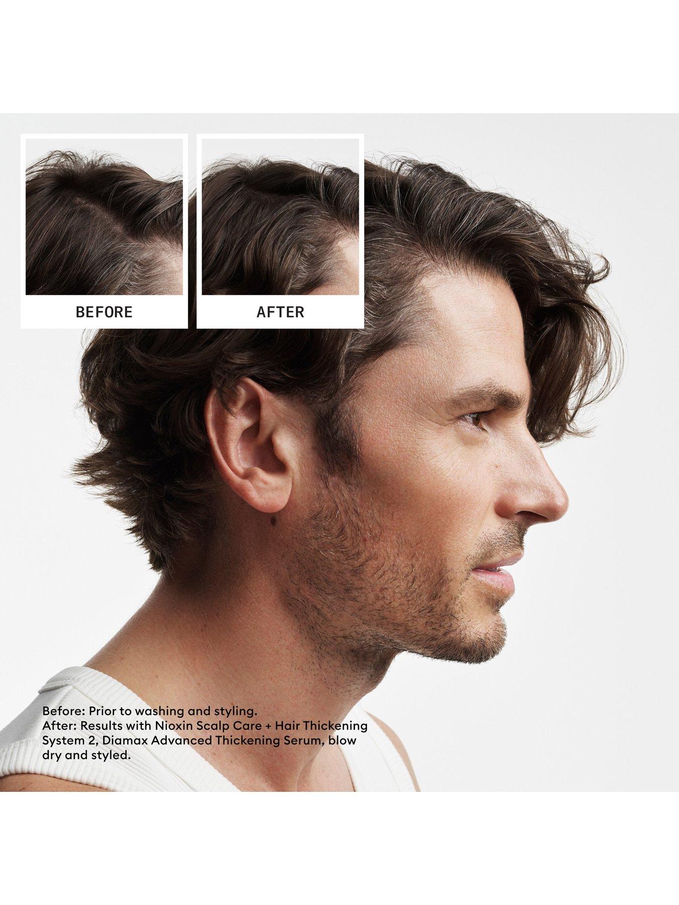 nioxin-scalp-hair-thickening-system-2-for-natural-hair-with-progressed-thinning-trial-kitdetail