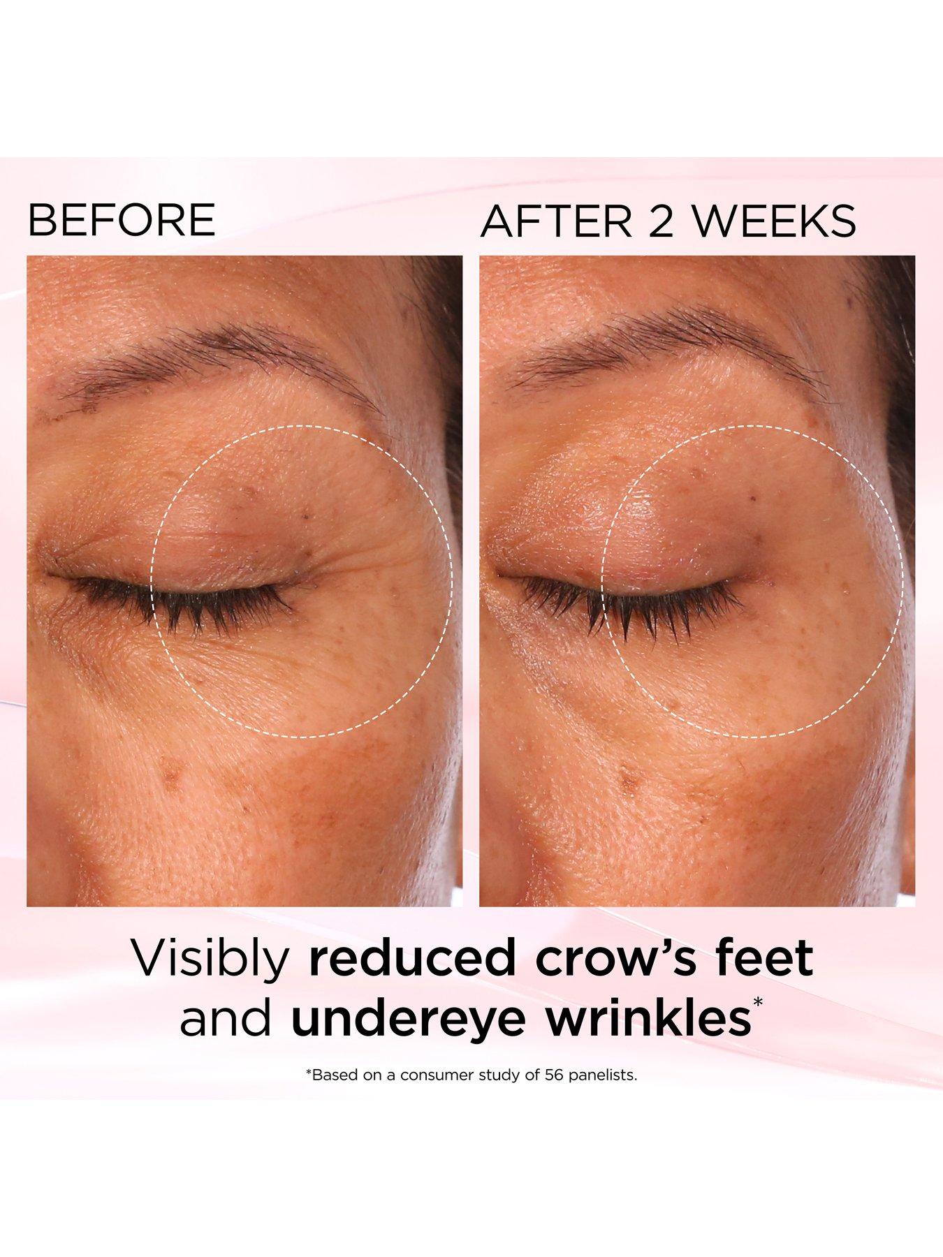 Image 6 of 7 of Elizabeth Arden Retinol + HPR Ceramide Rapid Skin Renewing Eye Cream, 15ml