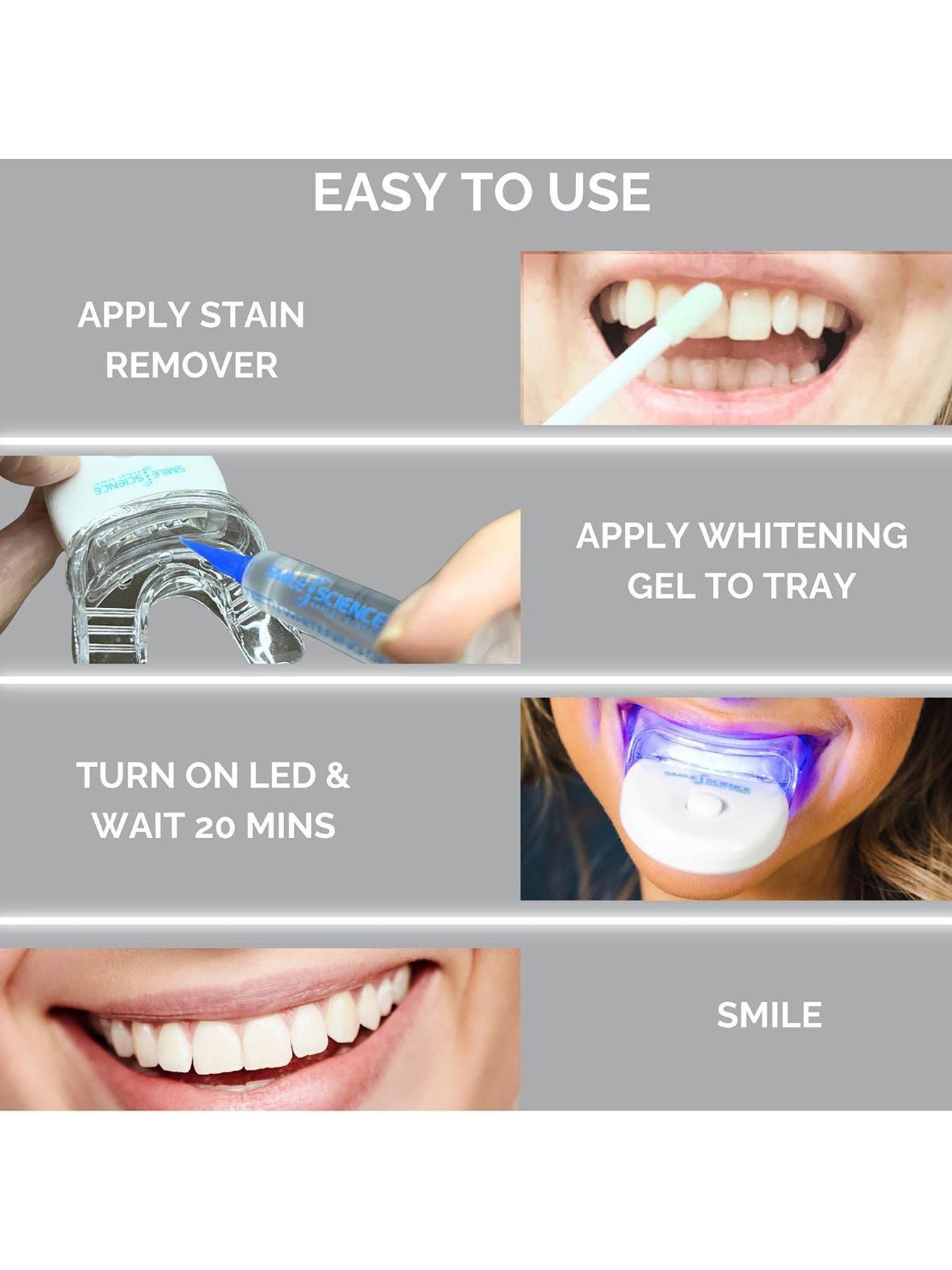 smile-science-smile-science-professional-home-whitening-kitback