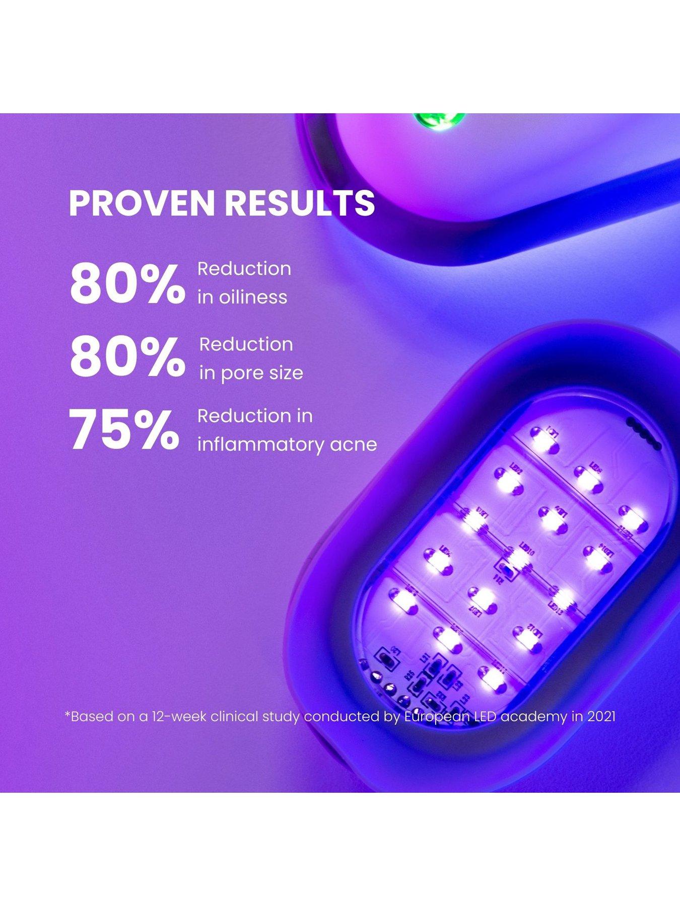 lustre-lustre-solo-led-acne-podoutfit