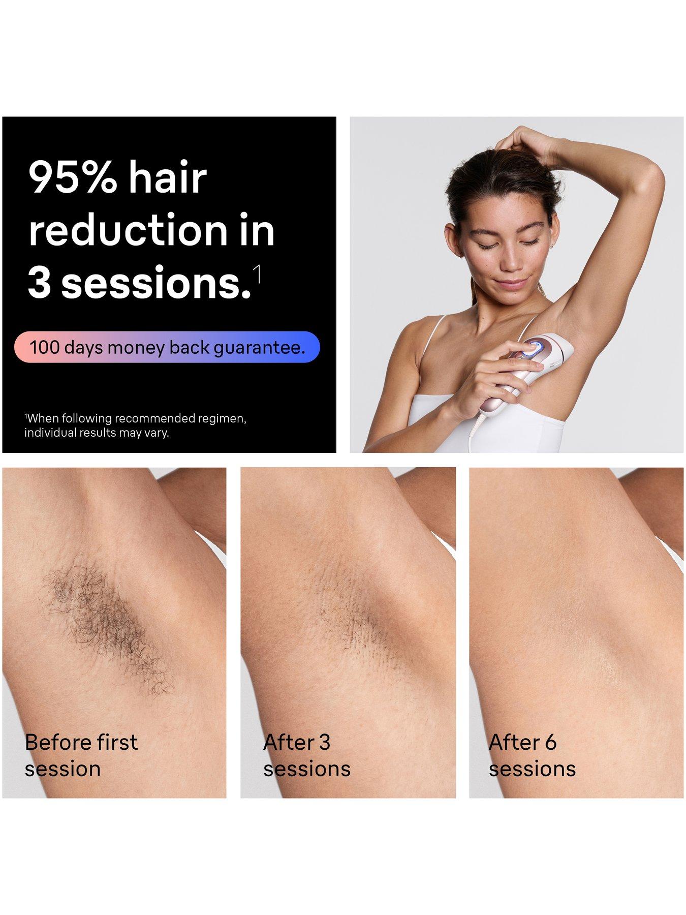 Image 5 of 7 of Braun Smart IPL Skin i-expert, At Home Hair Removal, With Free App, 2 Smart Heads, PL7211