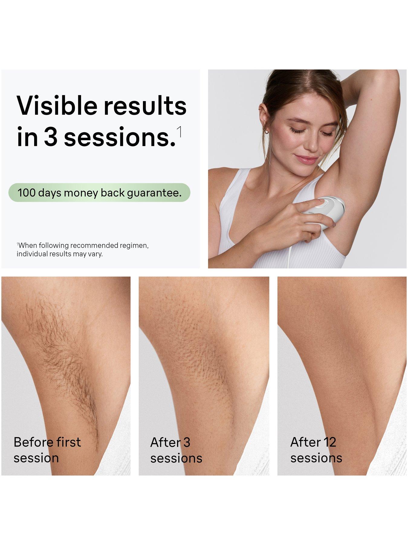 Image 3 of 7 of Braun IPL Silk-expert Mini, At Home Hair Removal, PL1114