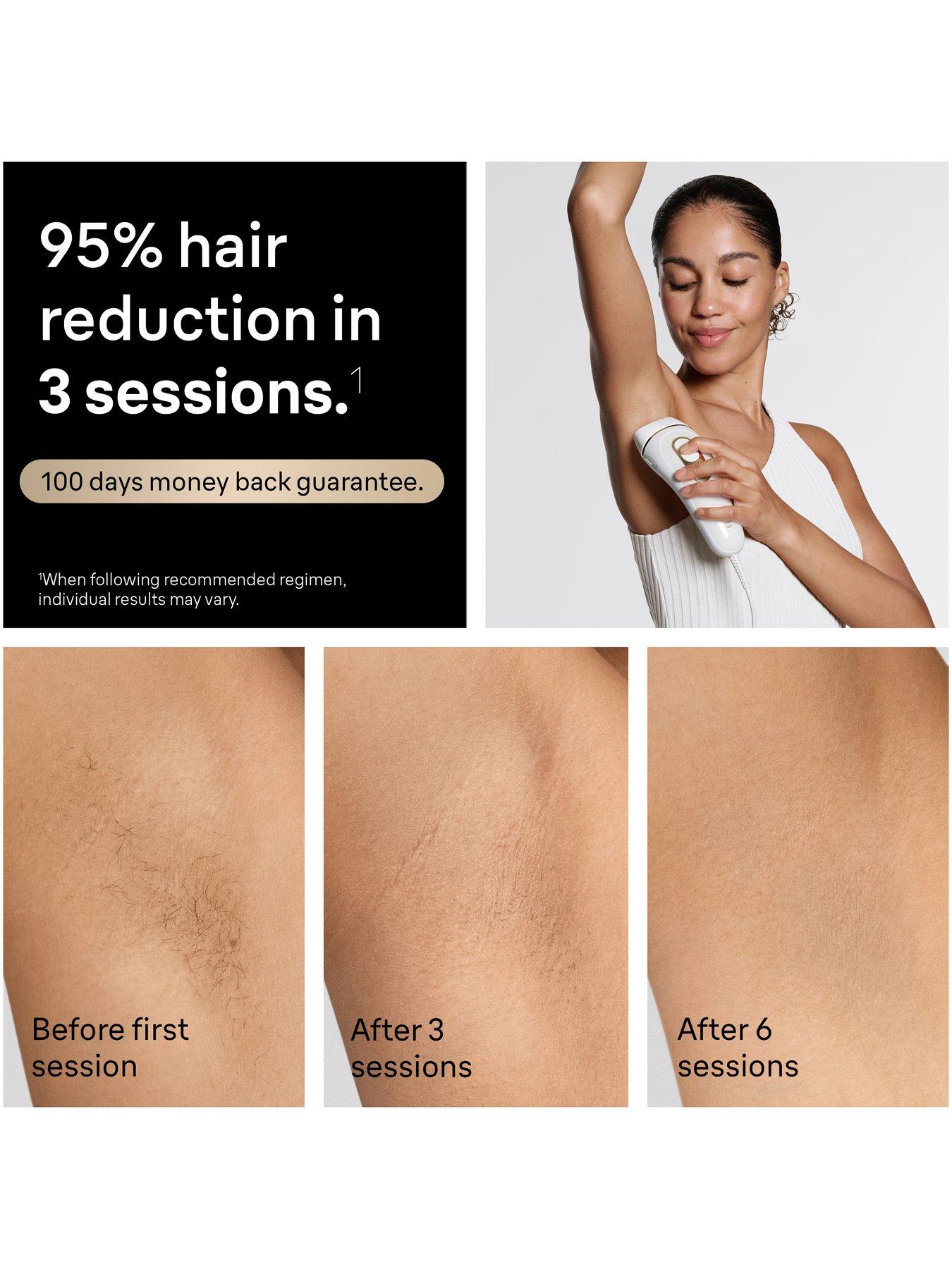 Image 4 of 7 of Braun IPL Silk-expert Pro 5, At Home Hair Removal, 2 Attachment Heads, PL5221