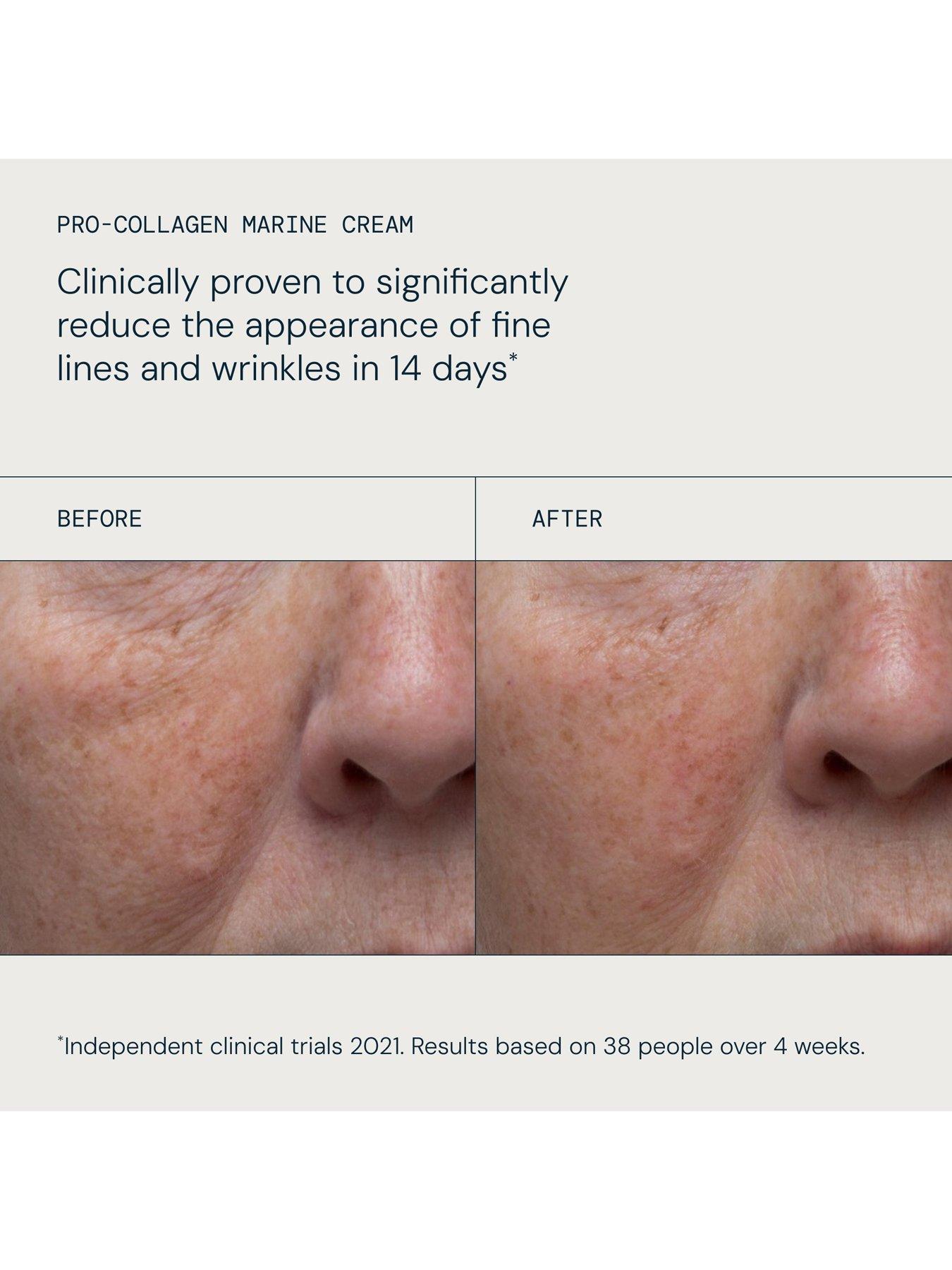 Image 4 of 5 of Elemis ELEMIS The Power of Pro-Collagen (Worth &pound;431, Saving 41%)