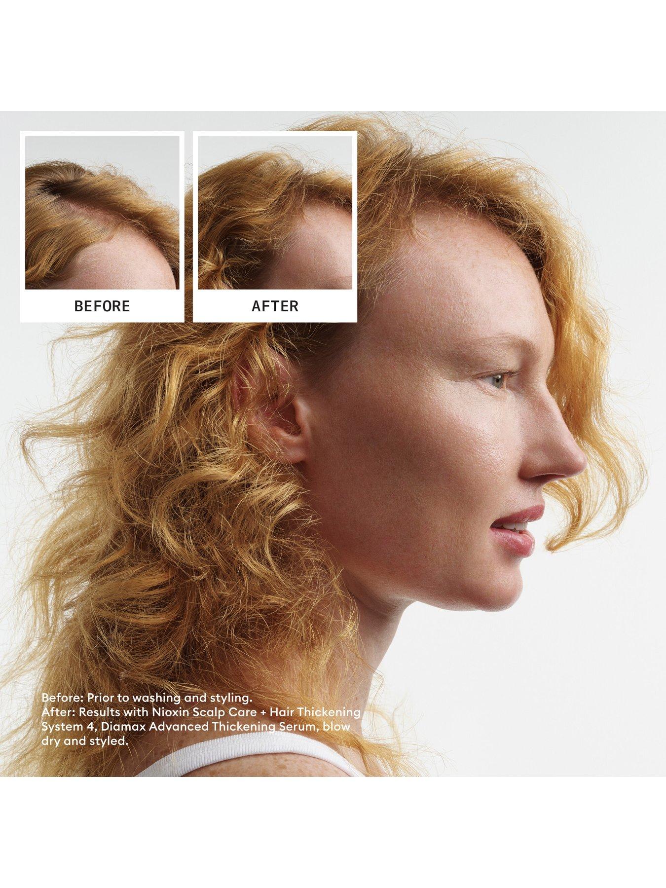 Image 3 of 7 of Nioxin Nioxin Pro Clinical Hair Density, Nourishing and and Anti-Breakage Haircare Set