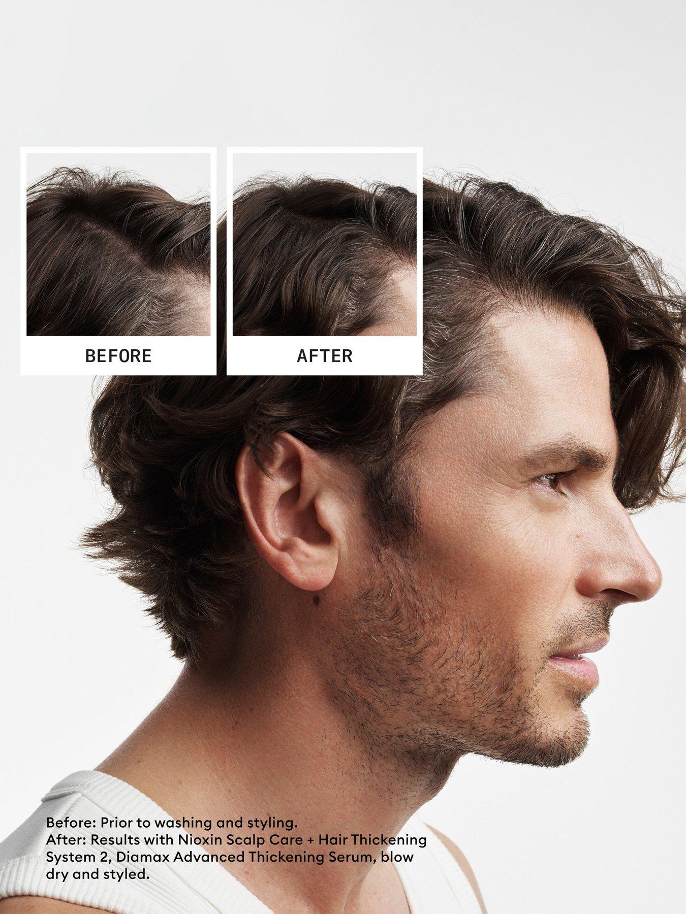 Image 3 of 7 of Nioxin Nioxin Pro Clinical Hair Density and and Anti-Breakage Haircare Set