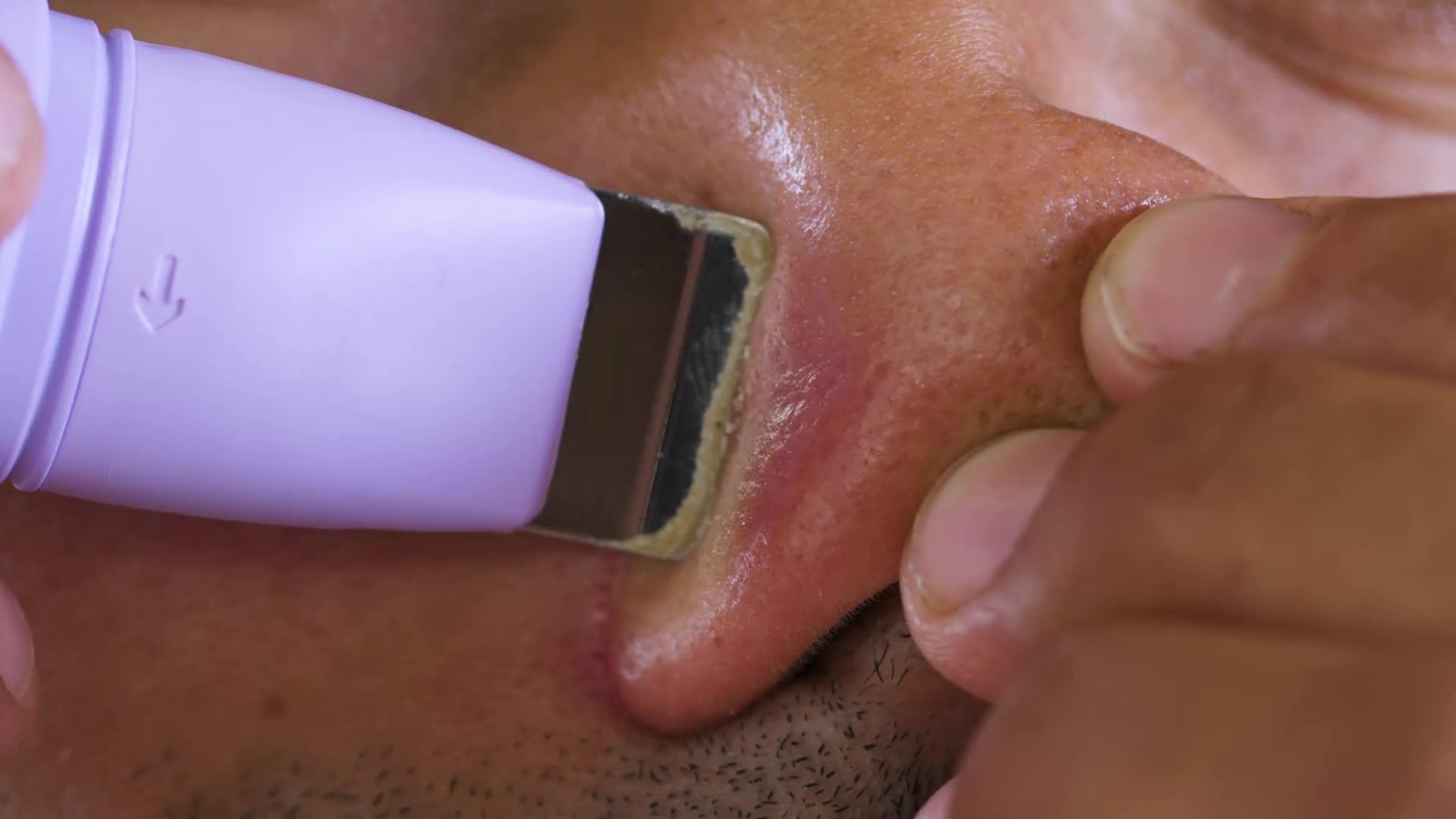 Image thumbnail 8 of 8 of Benefit The POREfessional Degunker Blackhead and Pore Cleansing System for Clogged Pores